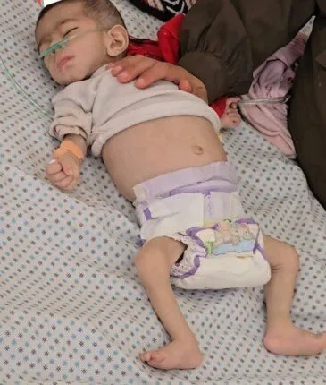 «سلاح التجويع» أهالي غزة يدخلون المرحلة الخامسة.. و«الأسبوع» توثق قتل البراءة في القطاع