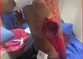 شجار عنيف أسفر عنAttempted Murder لطالب.. ما الذي حدث في العبور؟