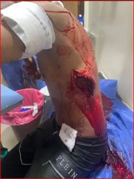 شجار عنيف أسفر عنAttempted Murder لطالب.. ما الذي حدث في العبور؟