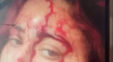 طليق يهاجم زوجته السابقة ويشوه وجهها ويخطف طفله: جريمة عائلية تهز منطقة البساتين