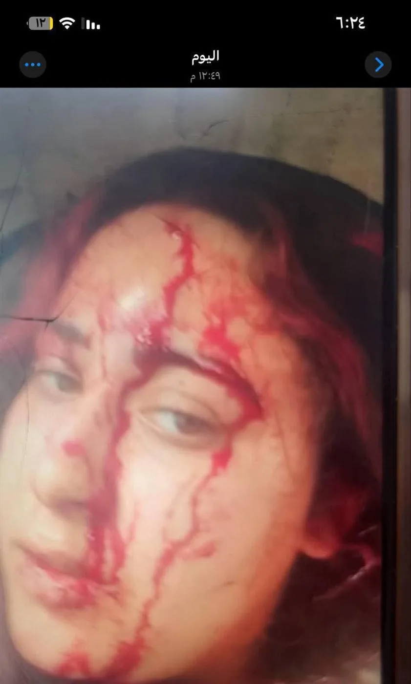 طليق يهاجم زوجته السابقة ويشوه وجهها ويخطف طفله: جريمة عائلية تهز منطقة البساتين طليق يهاجم زوجته السابقة ويشوه وجهها ويخطف طفله: جريمة عائلية تهز منطقة البساتين