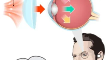 عاجل.. ابتكار عدسات لاصقة تمكنك من الرؤية في الظلام