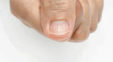 علامات على أظافر القدم تشير إلى مشكلات صحية خطيرة
