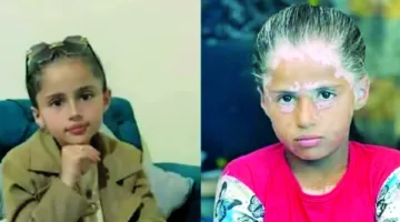 غزة: فظائع الحرب تودي بحياة الأطفال وتؤثر سلبًا على نفسية الناجين