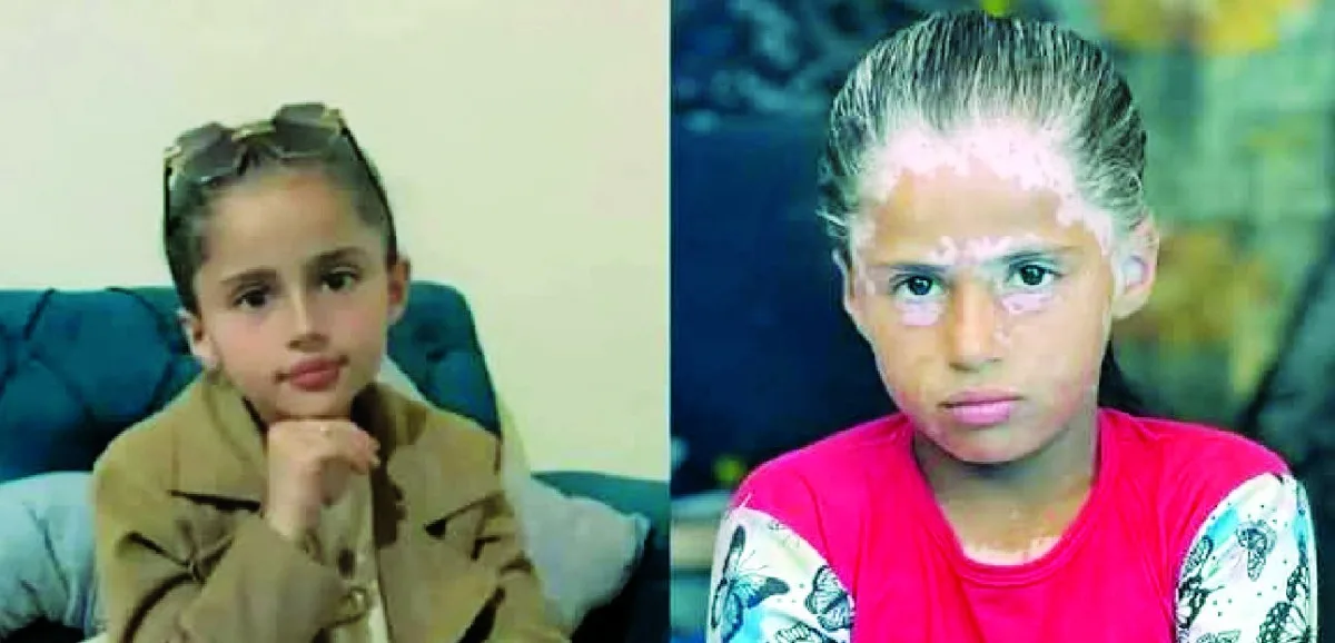 غزة: فظائع الحرب تودي بحياة الأطفال وتؤثر سلبًا على نفسية الناجين غزة: فظائع الحرب تودي بحياة الأطفال وتؤثر سلبًا على نفسية الناجين