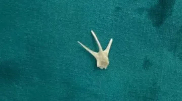 فريق طبي في جامعة سوهاج يتمكن من إزالة شوكة سمكة من مجرى الهواء لطفل.