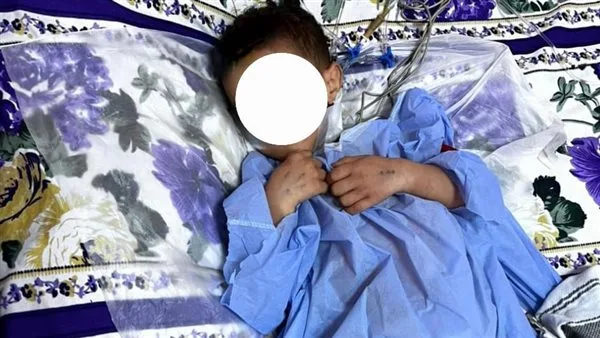 فريق طبي من مستشفيات جامعة سوهاج يتمكن من إنقاذ حياة طفل بعد تعرضه لحادث فريق طبي من مستشفيات جامعة سوهاج يتمكن من إنقاذ حياة طفل بعد تعرضه لحادث