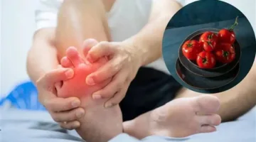 كيف يمكن للطماطم أن تسبب النقرس؟