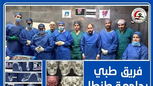 لاستئصال ورم خبيث بالفك .. فريق طبي بجامعة طنطا يجري جراحة معقدة لسيدة