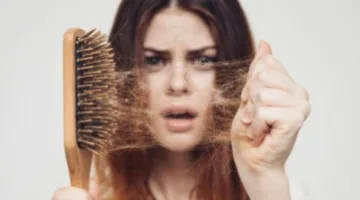 متى يُعتبر تساقط الشعر علامة على وجود حالة صحية خطيرة؟