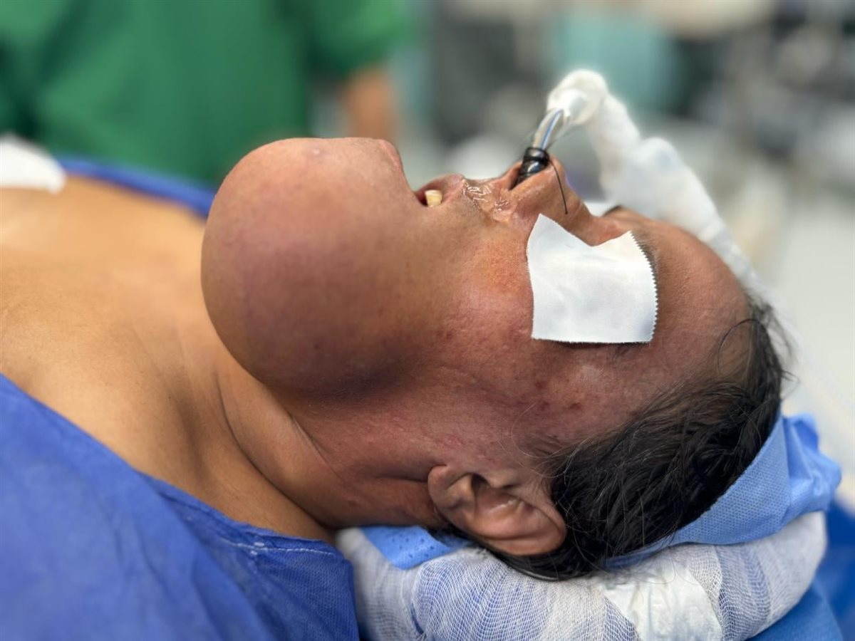 نجاح جراحة دقيقة لإزالة ورم من فك مريضة بمستشفى الشيخ زايد التخصصي