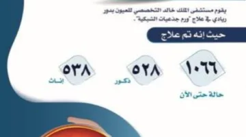 نجاح طبي: شفاء 1066 طفلًا من سرطان العين