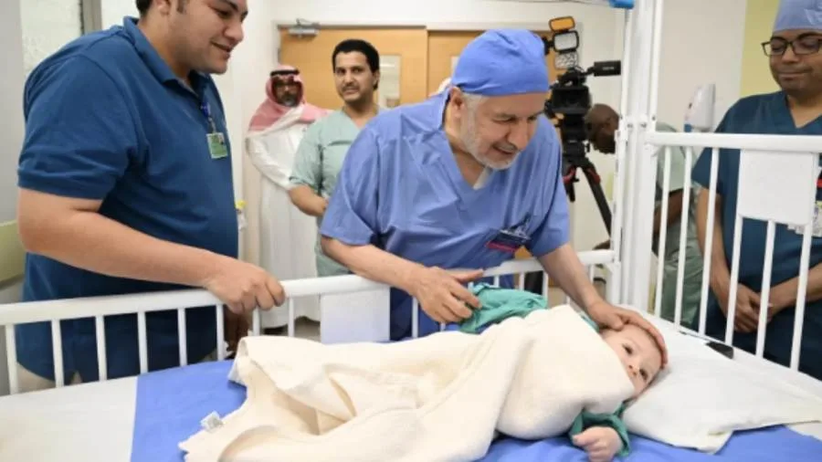 نجاح فصل التوأم الطفيلي المصري بالرياض بعد عملية جراحية معقدة استغرقت 8 ساعات