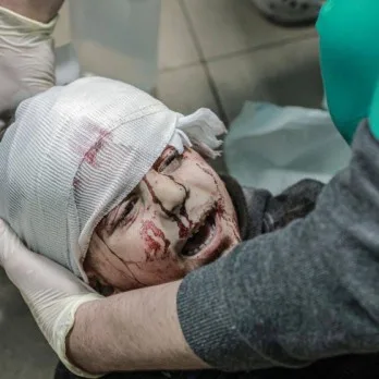 يوم دام جديد.. شهداء بينهم أطفال بمجازر إسرائيلية في مناطق متفرقة بغزة وحصيلة ضحايا الحرب ترتفع لـ 172 ألف بين شهيد وجريح يوم دام جديد.. شهداء بينهم أطفال بمجازر إسرائيلية في مناطق متفرقة بغزة وحصيلة ضحايا الحرب ترتفع لـ 172 ألف بين شهيد وجريح
