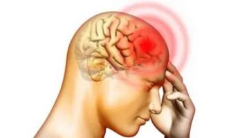 9 إشارات تدل على حدوث جلطة دماغية قبل أسابيع من وقوعها