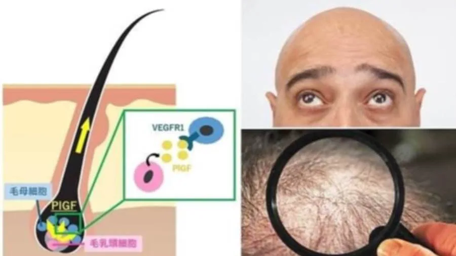 عاجل.. باحثون يجدون حلاً سهلاً لمشكلة تساقط الشعر عاجل.. باحثون يجدون حلاً سهلاً لمشكلة تساقط الشعر