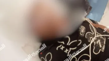 “كان يحلم بأن يصبح طبيبًا”.. «صغير أرض اللواء» يفقد عينه اليسرى نتيجة حادث مع علبتي عصير (فيديو)