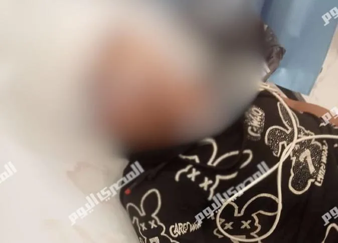 “كان يحلم بأن يصبح طبيبًا”.. «صغير أرض اللواء» يفقد عينه اليسرى نتيجة حادث مع علبتي عصير (فيديو) “كان يحلم بأن يصبح طبيبًا”.. «صغير أرض اللواء» يفقد عينه اليسرى نتيجة حادث مع علبتي عصير (فيديو)