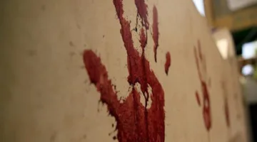 تجنب مسح الوجه بدم الأضحية: تحذيرات من مخاطر صحية جلدية خلال عيد الأضحى