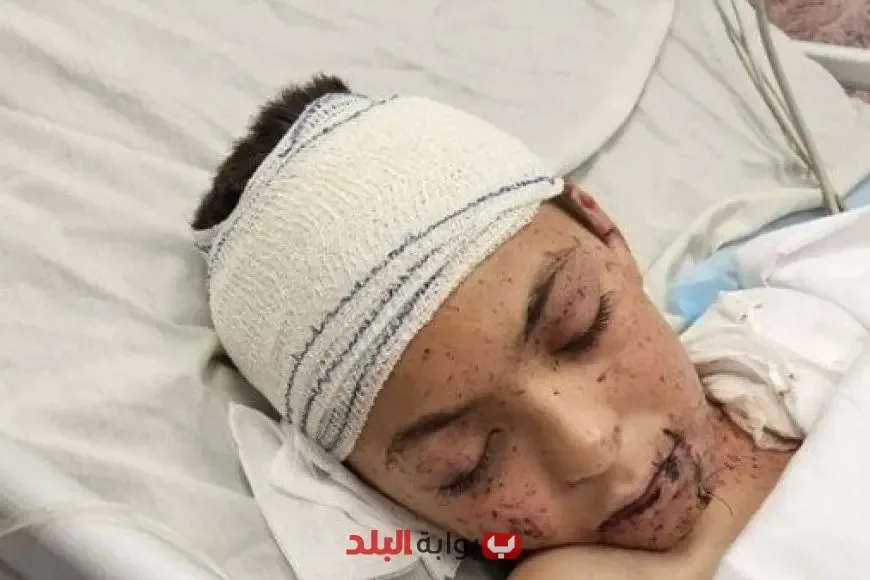 إيطاليا تعد نفسها لاستقبال طفل فلسطيني ناجٍ من الغارات الإسرائيلية الأسبوع المقبل. إيطاليا تعد نفسها لاستقبال طفل فلسطيني ناجٍ من الغارات الإسرائيلية الأسبوع المقبل.