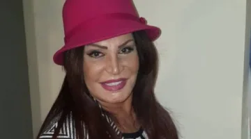 نجوى فؤاد تطمئن محبيها بعد إصابة ذراعها .. حصريًا