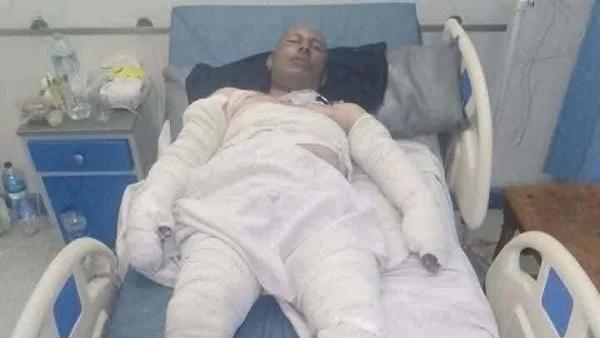 أنقذ المدينة من الكارثة: وفاة سائق سيارة البنزين المشتعلة في العاشر من رمضان أنقذ المدينة من الكارثة: وفاة سائق سيارة البنزين المشتعلة في العاشر من رمضان