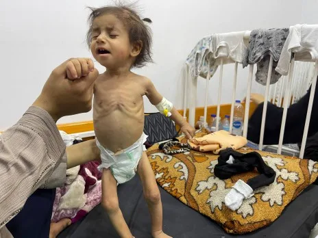 آلاء المقيد: الجوع في قطاع غزة كتهديد حتمي والمخاطر المستمرة التي تواجه الأجيال القادمة آلاء المقيد: الجوع في قطاع غزة كتهديد حتمي والمخاطر المستمرة التي تواجه الأجيال القادمة