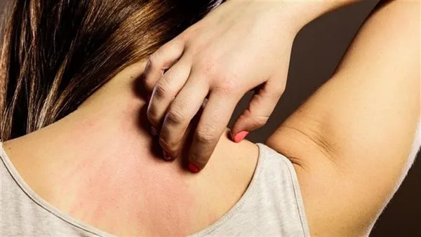اكتشف أبرز مسببات الحساسية الخطيرة اكتشف أبرز مسببات الحساسية الخطيرة