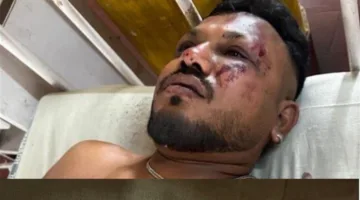 من بين 242 شخصاً، لقطات توثق خروج الناجي الوحيد من حادثة تحطم الطائرة الهندية