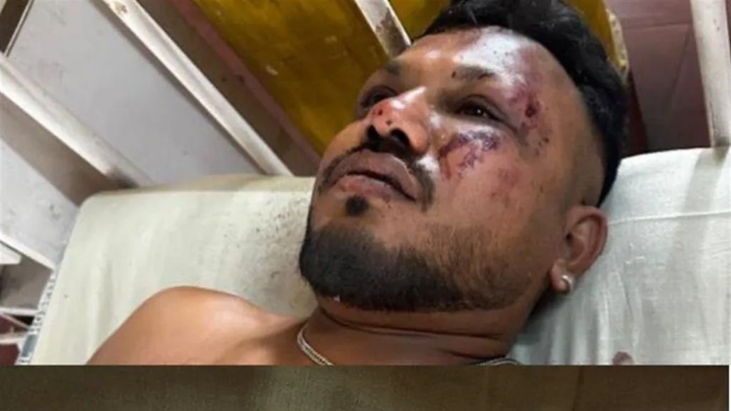 من بين 242 شخصاً، لقطات توثق خروج الناجي الوحيد من حادثة تحطم الطائرة الهندية من بين 242 شخصاً، لقطات توثق خروج الناجي الوحيد من حادثة تحطم الطائرة الهندية