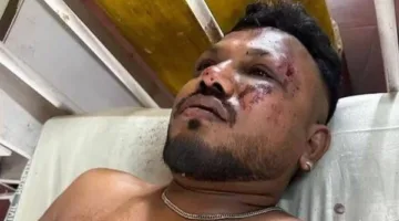 شاهد: الناجي الفريد من حادث الطائرة الهندية