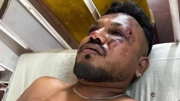 شاهد: الناجي الفريد من حادث الطائرة الهندية شاهد: الناجي الفريد من حادث الطائرة الهندية
