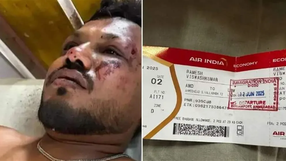 الناجي الفريد من حادثة تحطم الطائرة الهندية يشارك تفاصيل “المأساة” الناجي الفريد من حادثة تحطم الطائرة الهندية يشارك تفاصيل “المأساة”