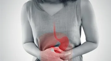 ما هو التهاب القولون الناجم عن القرحة؟ وكيف يُشخّص؟