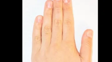 ما هو تأثير طول الأصابع على صحتك؟