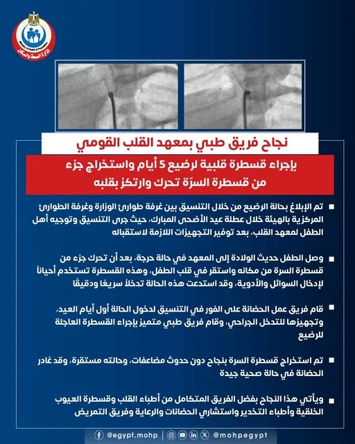 معهد القلب يحقق إنجازًا بإجراء قسطرة قلبية لطفل رضيع عمره 5 أيام معهد القلب يحقق إنجازًا بإجراء قسطرة قلبية لطفل رضيع عمره 5 أيام