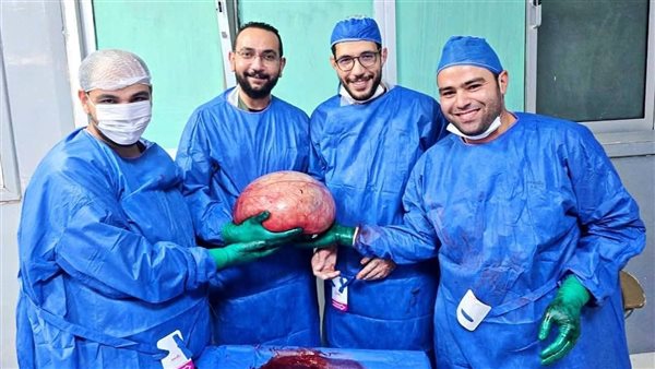 إنجاز طبي.. فريق طبي بمستشفى الفيوم العام يزيل ورماً يزن 15 كيلوغراماً من فتاة شابة