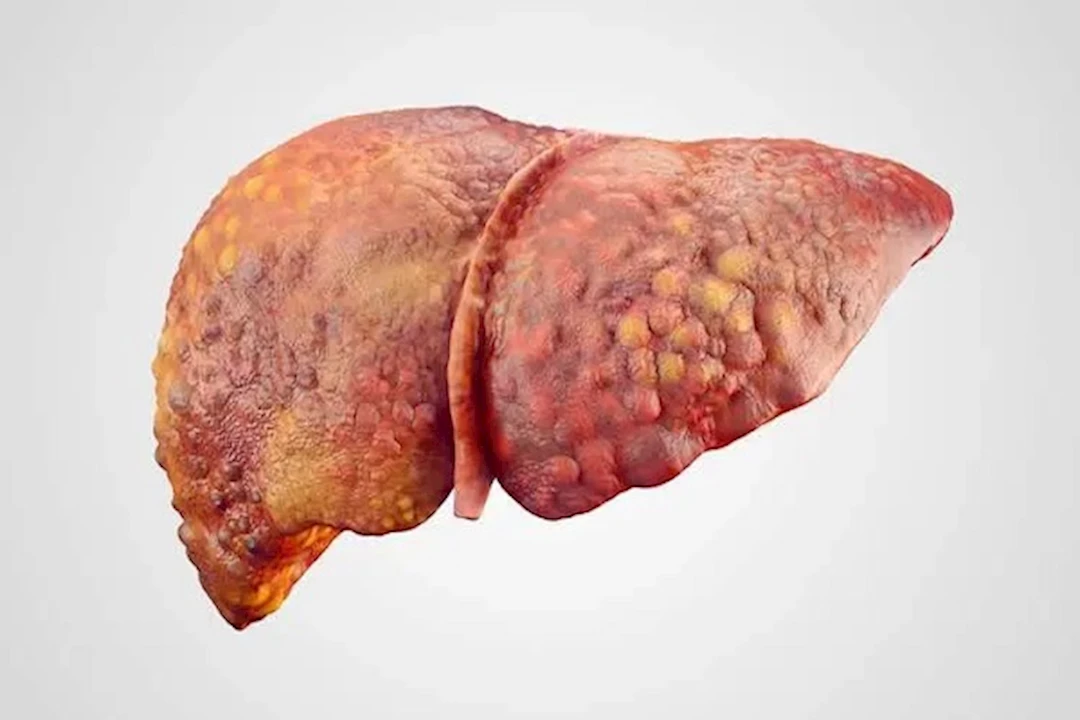 3 عوامل خطيرة تؤدي إلى تليف الكبد.. تجنبها فوراً3 عوامل خطيرة تؤدي إلى تليف الكبد.. ابتعد عنها فوراً 3 عوامل خطيرة تؤدي إلى تليف الكبد.. تجنبها فوراً3 عوامل خطيرة تؤدي إلى تليف الكبد.. ابتعد عنها فوراً