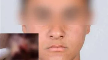سائق أوبر يعتدي على شاب في المعادي ويخدش وجهه بـ 64 غرزة (فيديو)