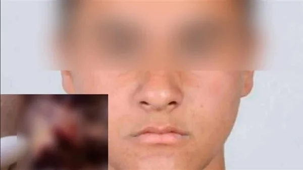 سائق أوبر يعتدي على شاب في المعادي ويخدش وجهه بـ 64 غرزة (فيديو)