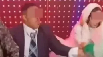 بعد خطبة مع شاب مصاب بمتلازمة داون: كافة المعلومات حول المرض