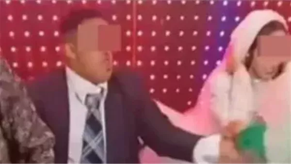 بعد خطبة مع شاب مصاب بمتلازمة داون: كافة المعلومات حول المرض بعد خطبة مع شاب مصاب بمتلازمة داون: كافة المعلومات حول المرض