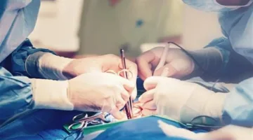 فريق الطب في قصر العيني يحقق نجاحاً في إجراء جراحة نادرة ومعقدة باستخدام جهاز ECMO.