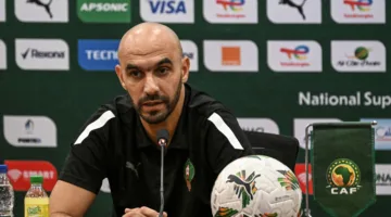 ركراكي: إذا لم أعد جذابًا لكم، سأنتقل إلى تركيا لإجراء زراعة الشعر.