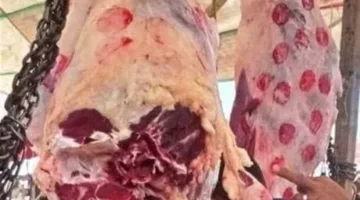 «الأفضل».. استشاري معدة: اللحوم والكبد والعدس من أبرز مصادر الحديد