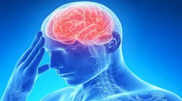 السكتة الدماغية غير المفسرة عند النساء: دراسات تكشف الحقيقة