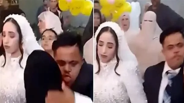 المجلس القومي للطفولة يوضح رأيه بشأن زواج شخص مصاب بمتلازمة داون من عروس من الشرقية المجلس القومي للطفولة يوضح رأيه بشأن زواج شخص مصاب بمتلازمة داون من عروس من الشرقية
