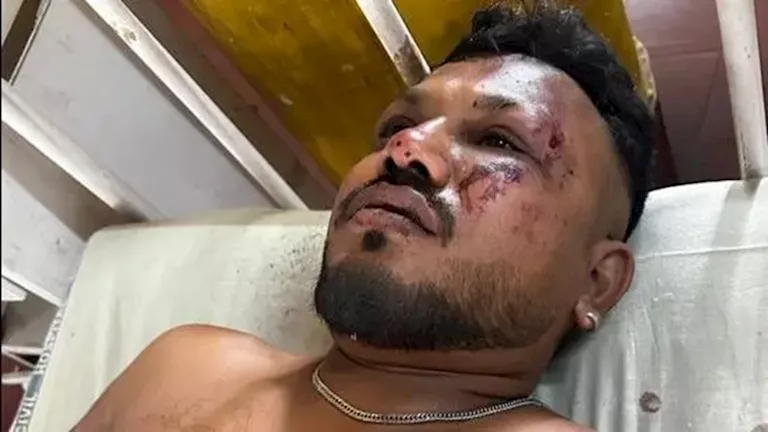 الناجي الفريد من حادث الطائرة الهندية يروي تفاصيل ما جرى الناجي الفريد من حادث الطائرة الهندية يروي تفاصيل ما جرى