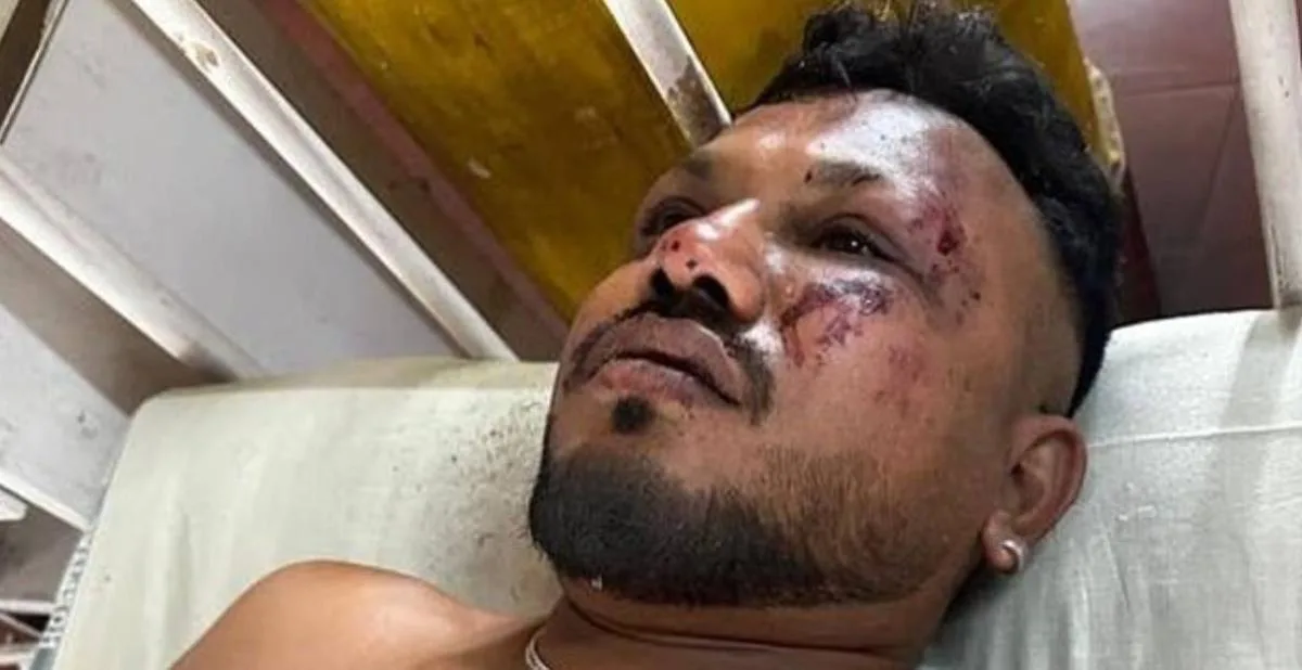 الناجي الوحيد من طاقم الطائرة الهندية يشارك لحظات رعب (فيديو) الناجي الوحيد من طاقم الطائرة الهندية يشارك لحظات رعب (فيديو)