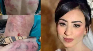 حادثة مهرائيل صبري: 8 ساعات من暴力 والاعتداء تؤدي إلى القبض على الزوج واحتجازه من قبل النيابة